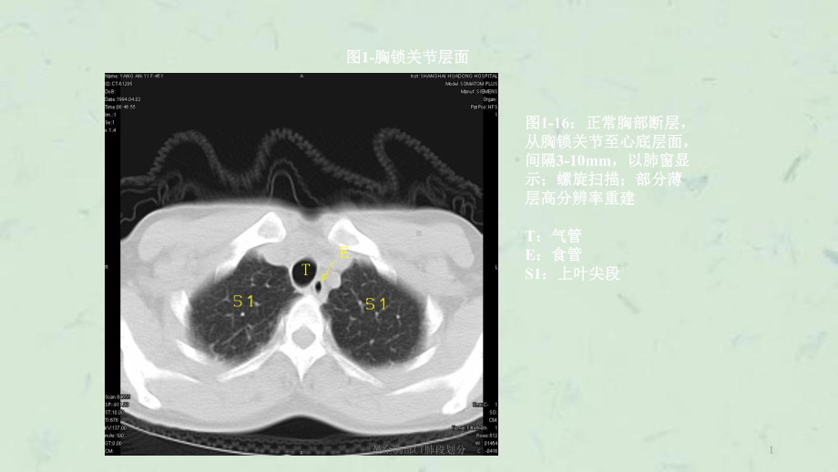 最全胸部CT肺段划分课件.ppt_第1页