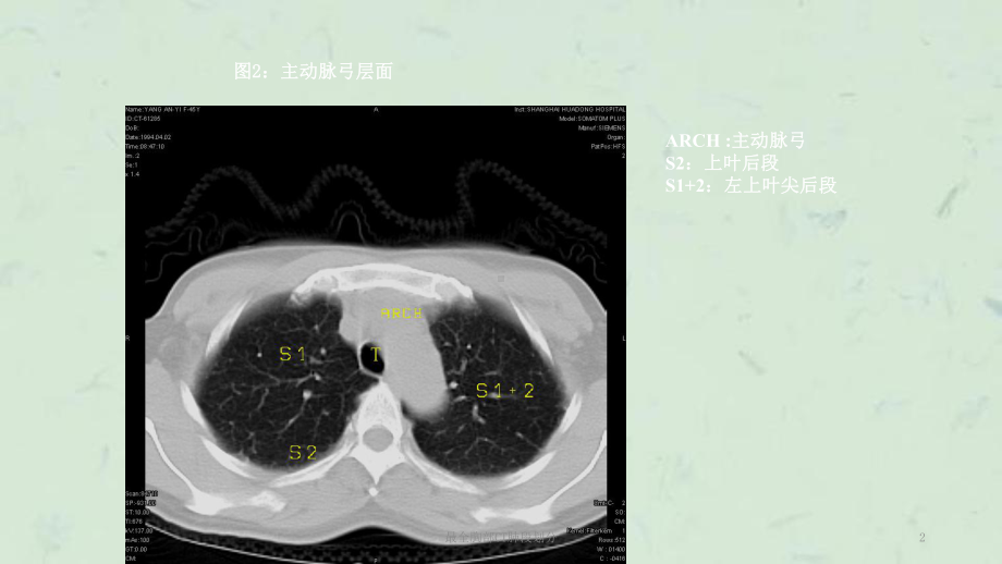 最全胸部CT肺段划分课件.ppt_第2页