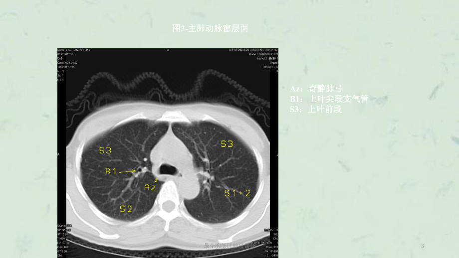 最全胸部CT肺段划分课件.ppt_第3页