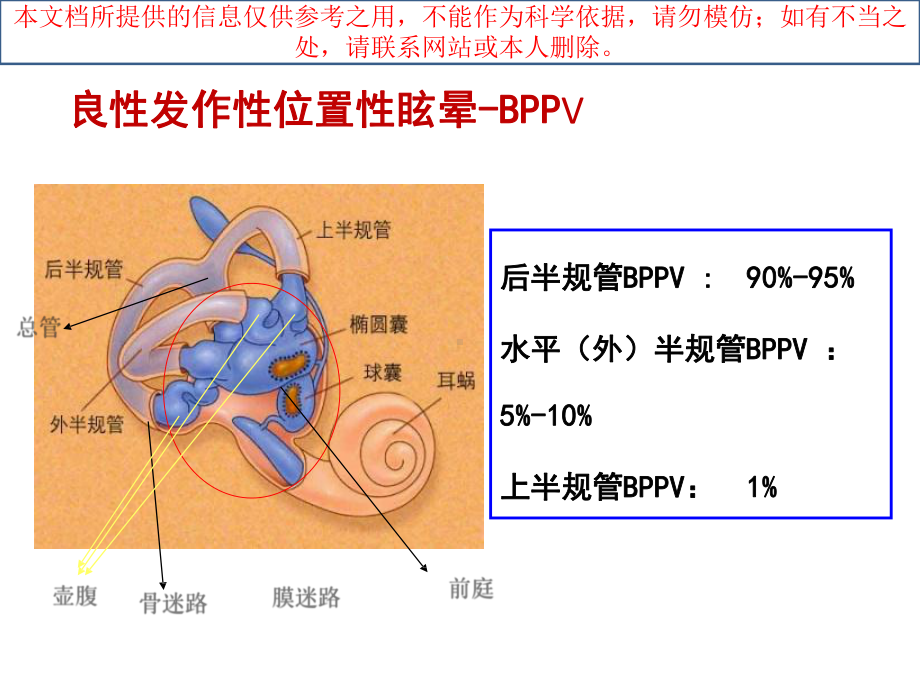 常见类耳石症的手法复位医学培训课件.ppt_第2页