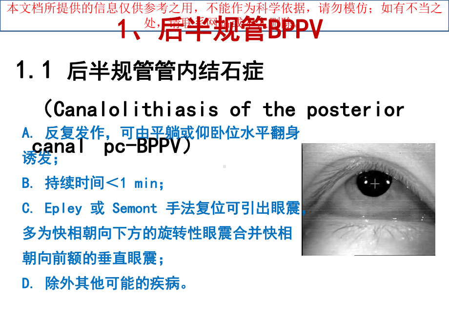 常见类耳石症的手法复位医学培训课件.ppt_第3页