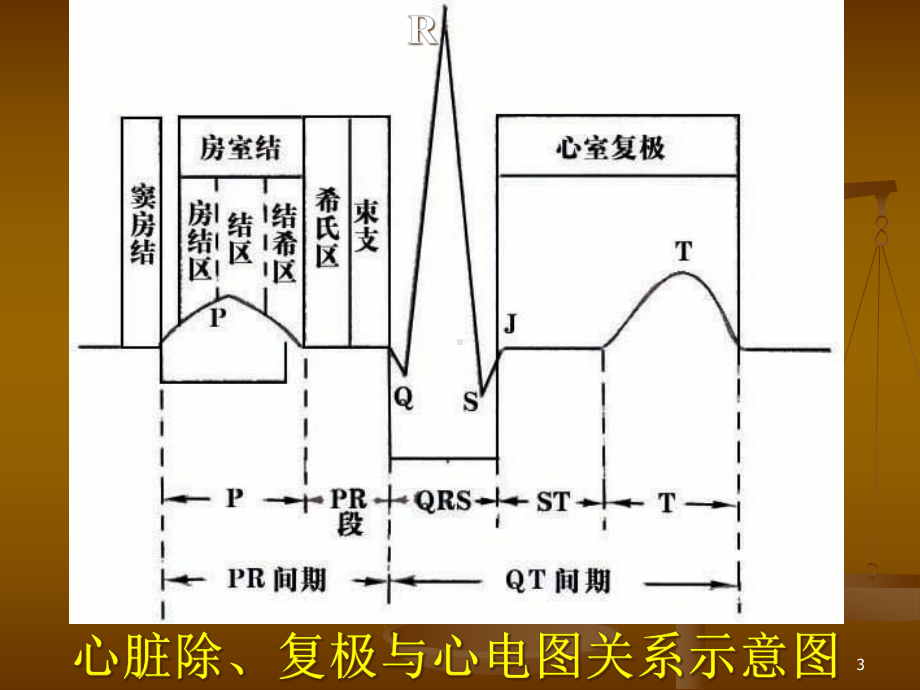 快速心电图入门教学课件.ppt_第3页