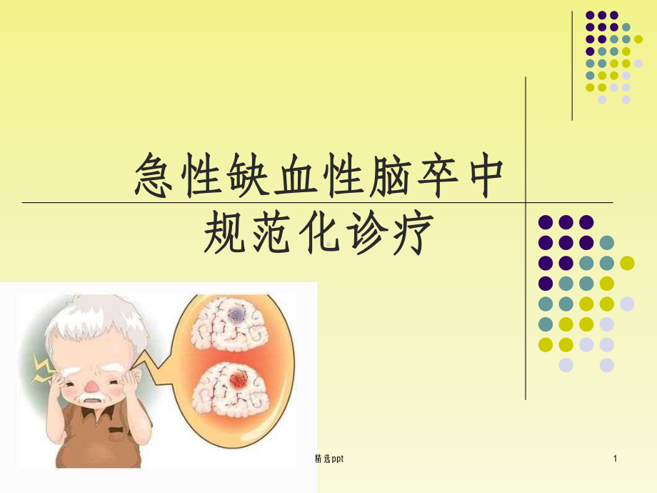 急性缺血性脑卒中课件.ppt_第1页