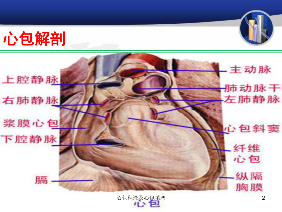 心包积液及心包填塞培训课件.ppt_第2页