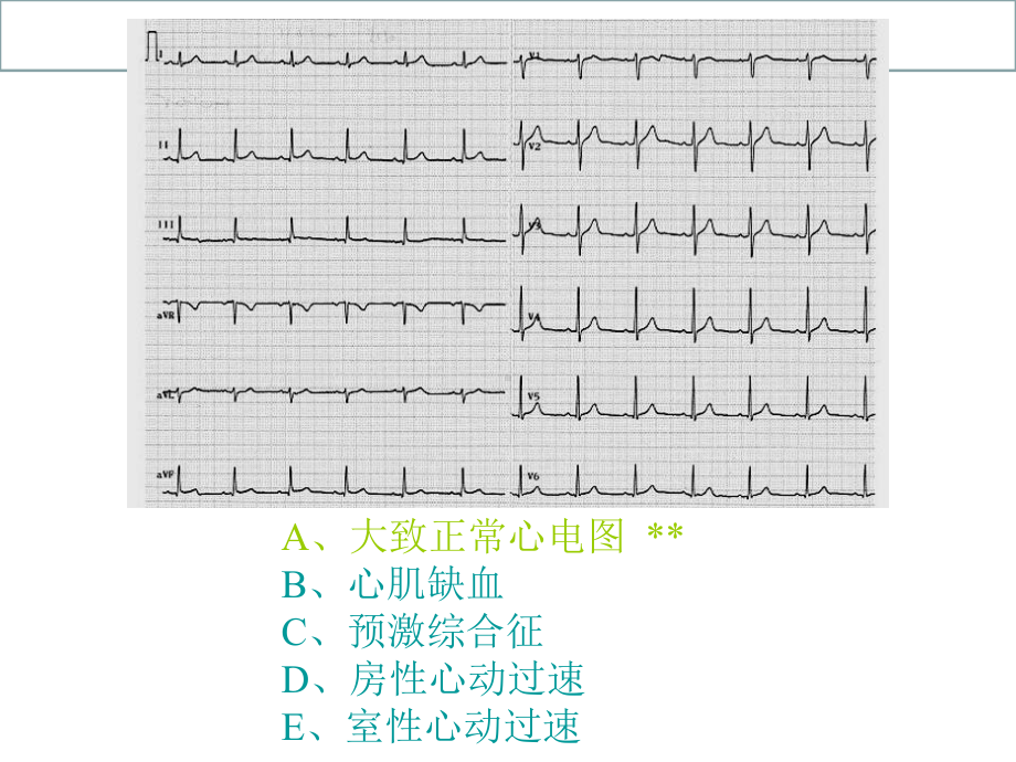 心电图X光片测试题目课件.ppt_第1页