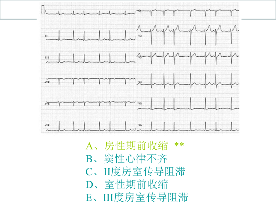 心电图X光片测试题目课件.ppt_第2页