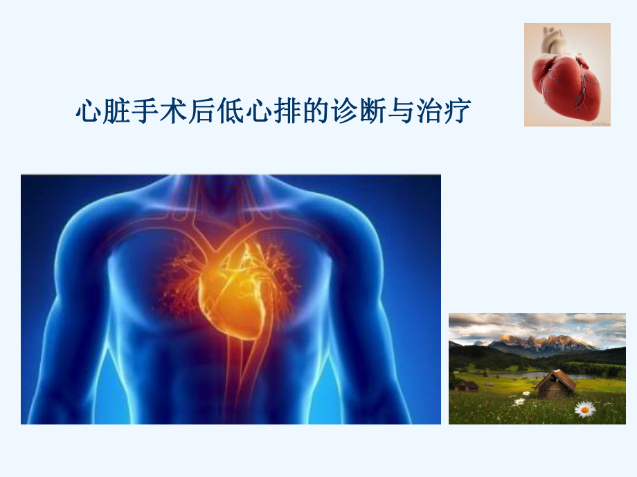 心脏手术后低心排的诊断与治疗课件.ppt_第1页