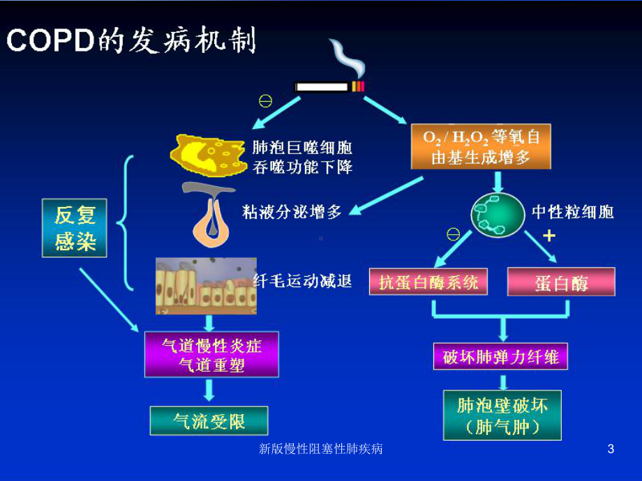 新版慢性阻塞性肺疾病培训课件.ppt_第3页