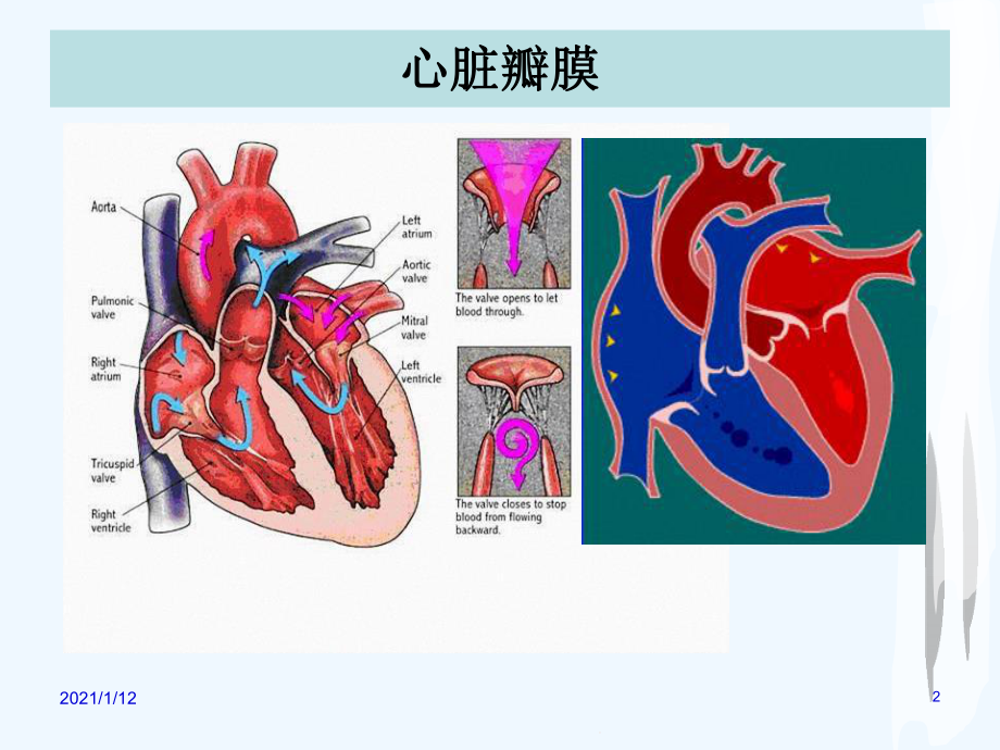 护理查房心脏瓣膜病课件.ppt_第2页