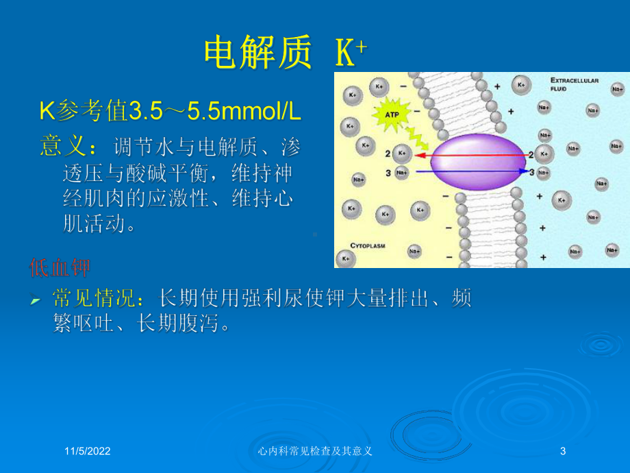 心内科常见检查及其意义培训课件.ppt_第3页