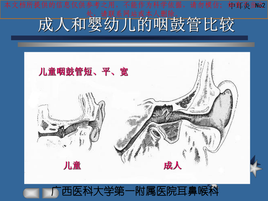 急性化脓性中耳炎培训课件.ppt_第2页