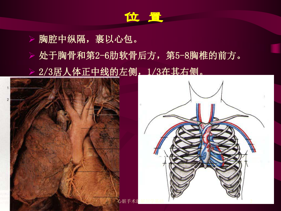 心脏手术的解剖学基础培训课件.ppt_第2页