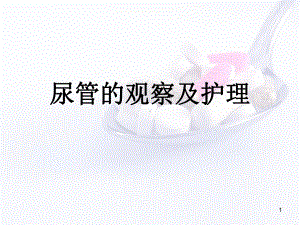 尿管的观察及护理学习课件.ppt