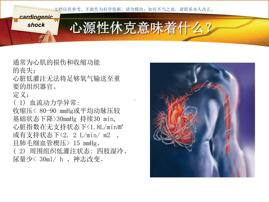 心源性休克医学知识课件.ppt_第2页