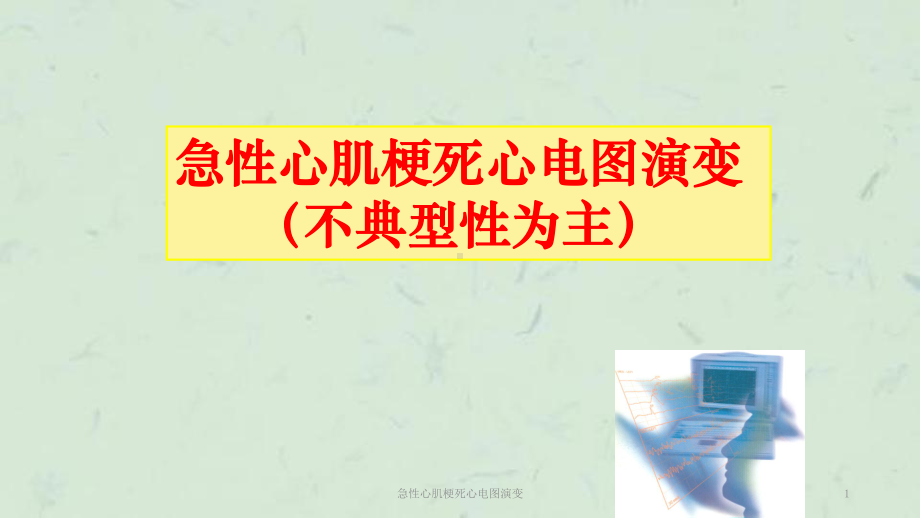 急性心肌梗死心电图演变课件.ppt_第1页