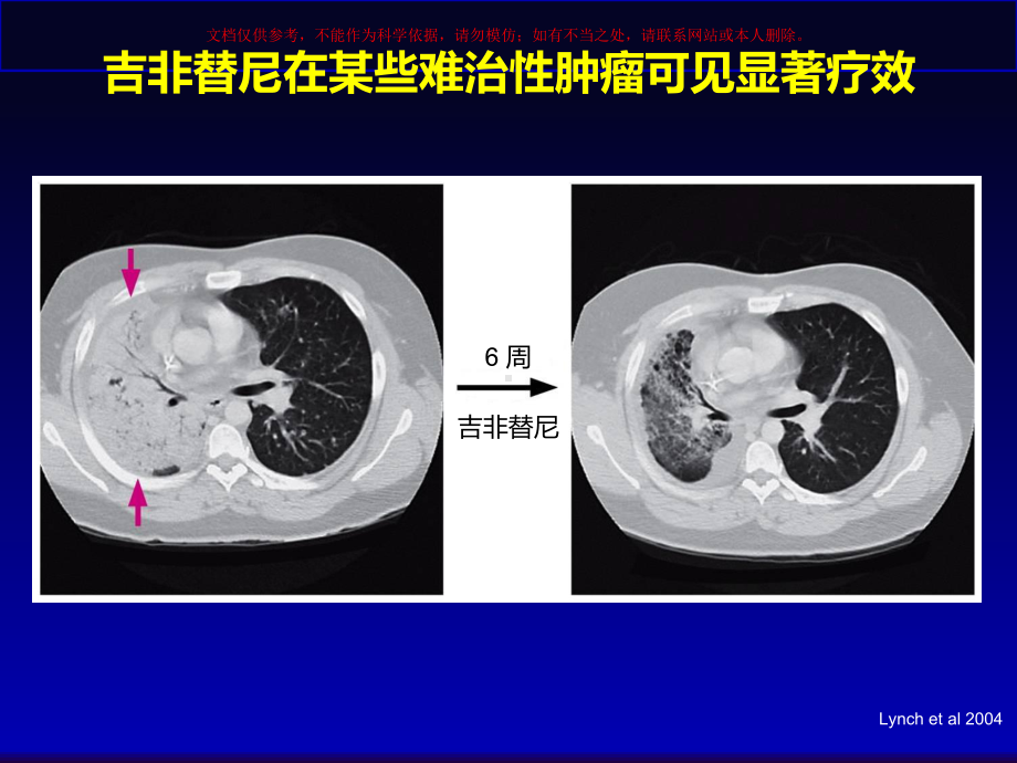 晚期NSCLC治疗的变革课件.ppt_第2页