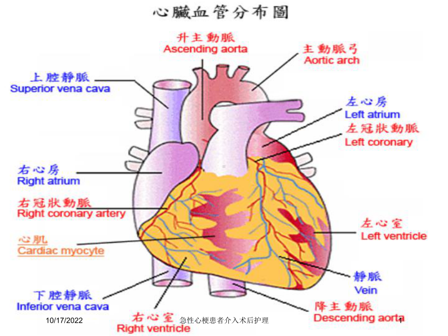 急性心梗患者介入术后护理培训课件.ppt_第1页