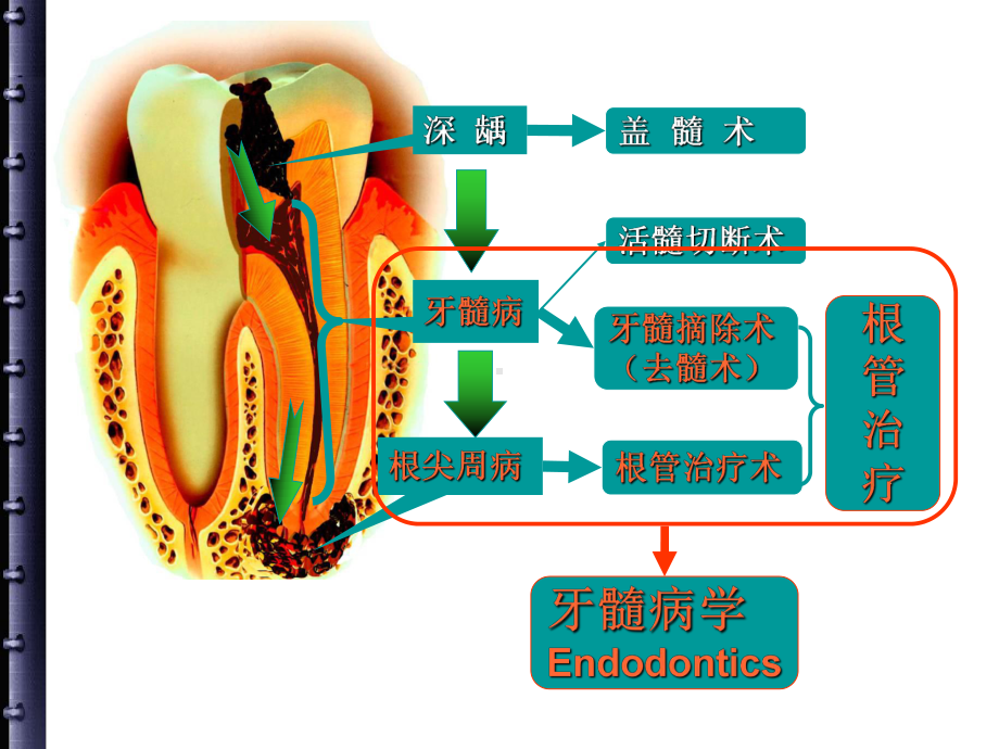 根尖周病的治疗参考课件.ppt_第2页