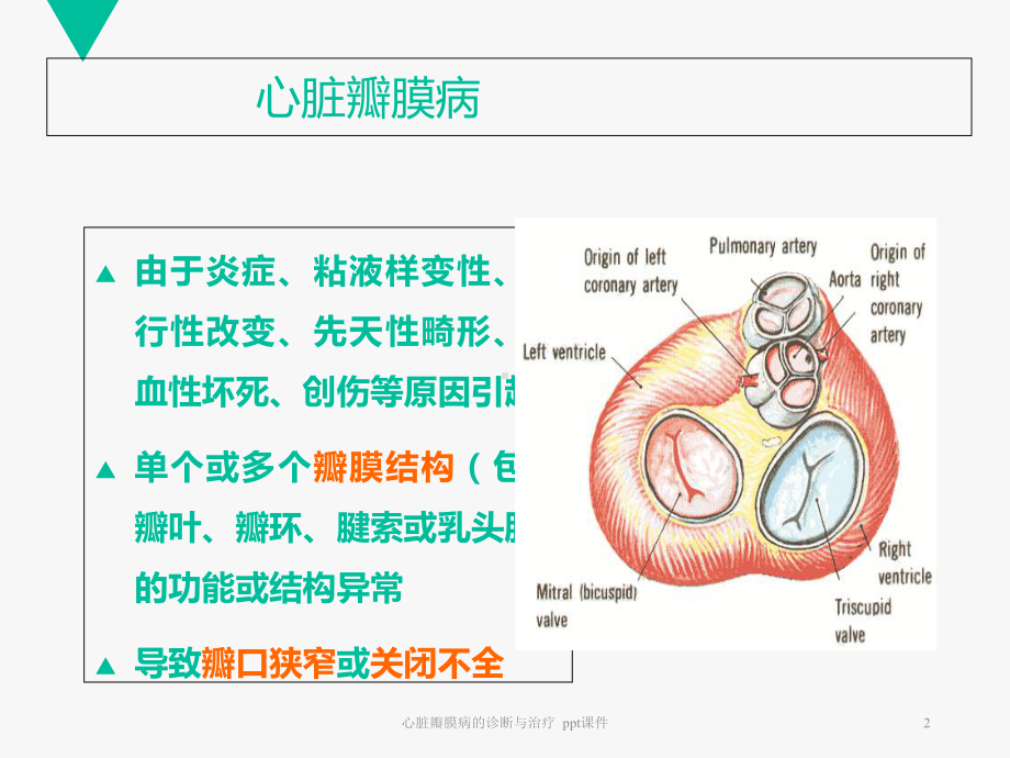 心脏瓣膜病的诊断与治疗-课件.ppt_第2页