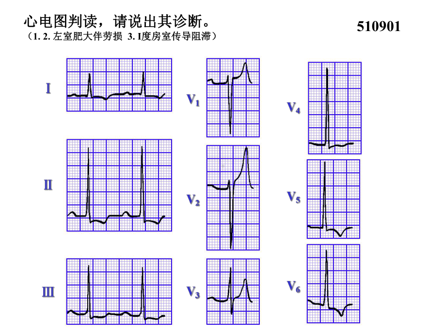 心电图试题及答案-课件.ppt_第1页