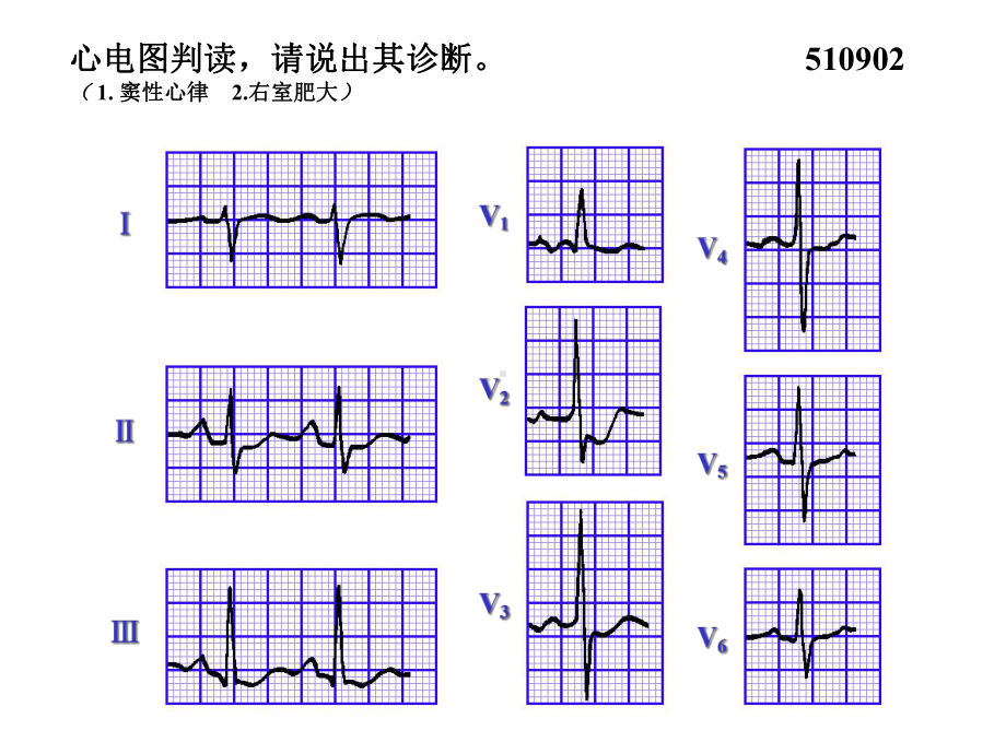 心电图试题及答案-课件.ppt_第2页