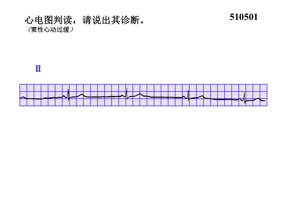 心电图试题及答案-课件.ppt_第3页