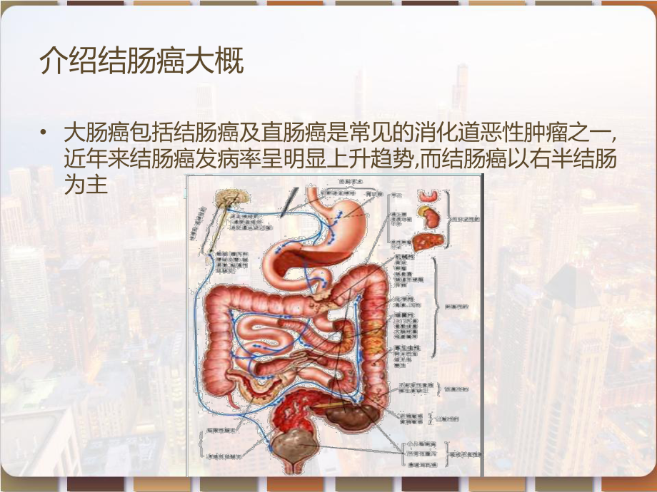 恶性肿瘤病人常见症状的护理-课件.pptx_第2页