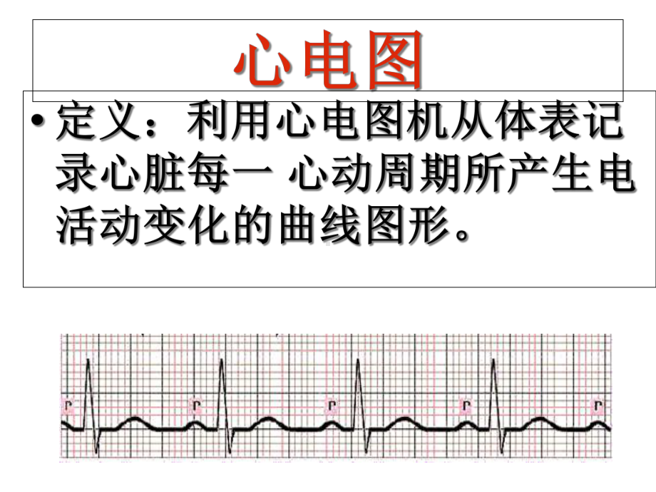 心电图的基本知识-课件.ppt_第2页