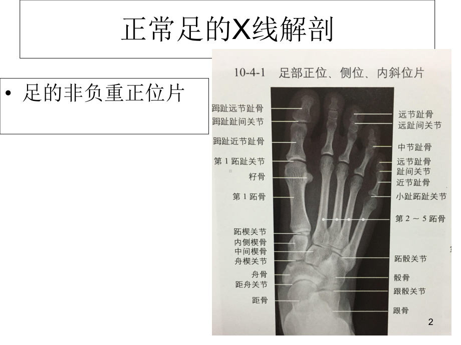 常见足部畸形疾病X线评估参考课件.ppt_第2页