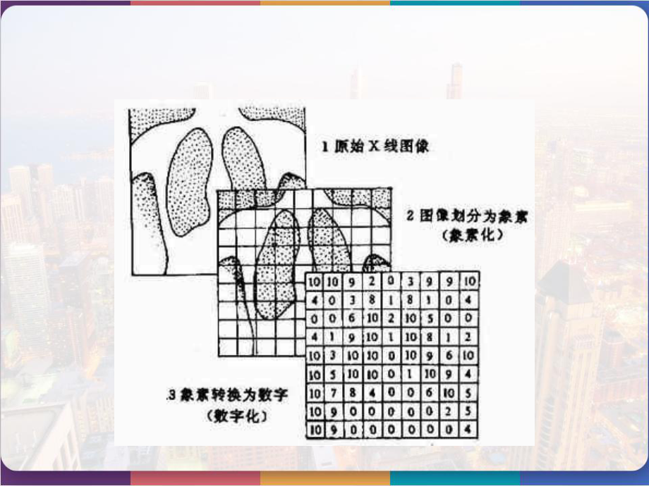 数字减影血管造影-课件.pptx_第3页