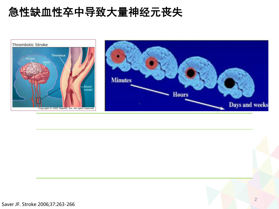 急性脑梗死溶栓流程及临床实践教学课件.ppt_第2页