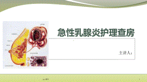 急性乳腺炎护理查房-课件.ppt