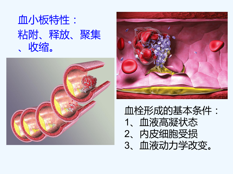 心血管疾病溶栓抗栓治疗课件.ppt_第3页