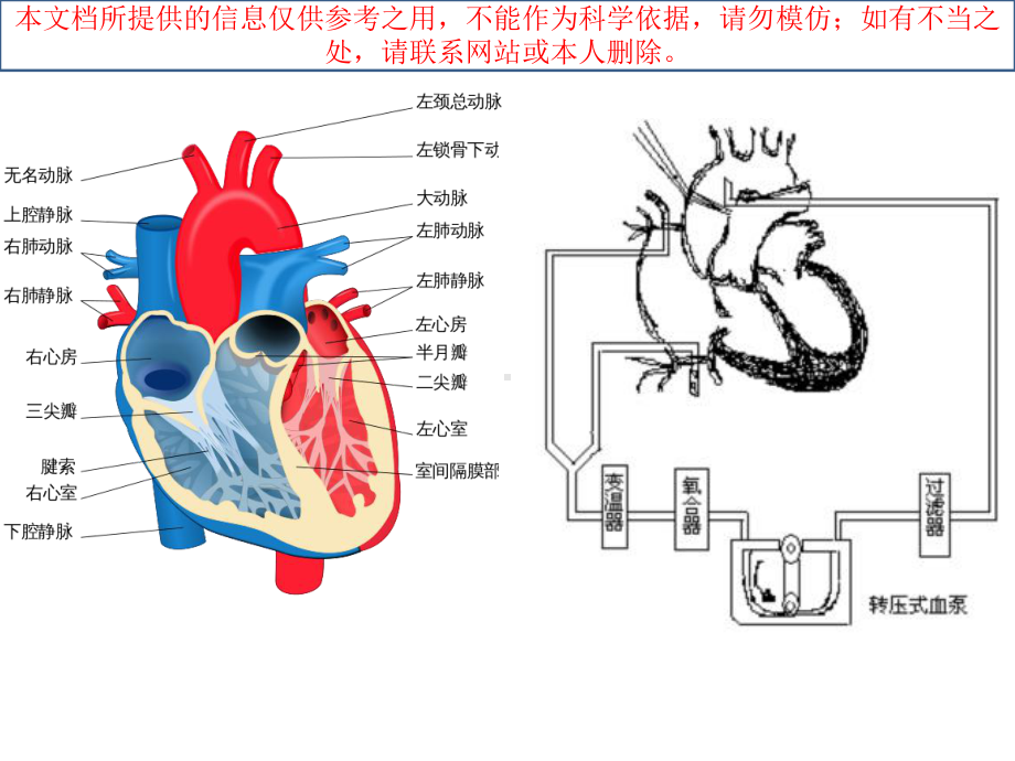 心脏手术麻醉的一般流程培训课件.ppt_第1页