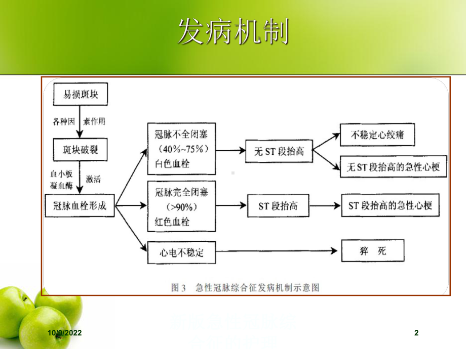 新版急性冠脉综合征的护理培训课件.ppt_第2页