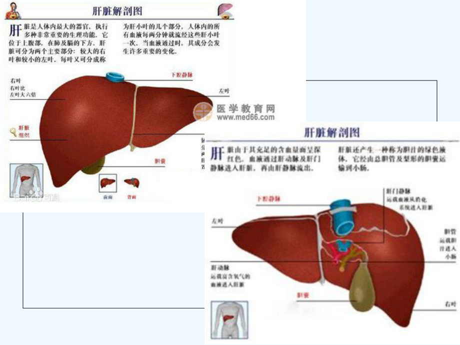 普外1肝硬化病人的护理查房课件.ppt_第3页