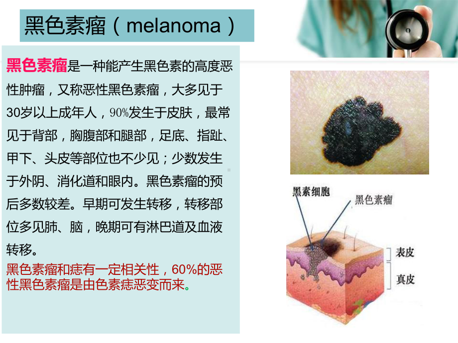 恶性黑色素瘤患者的护理教材课件.ppt_第3页