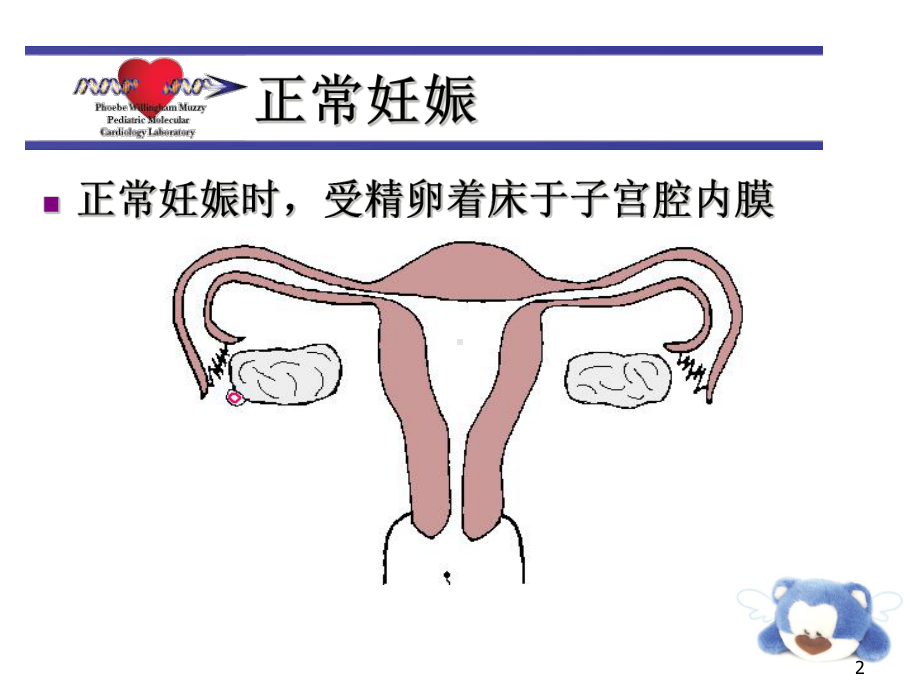 异位妊娠医学知识讲座课件.ppt_第2页