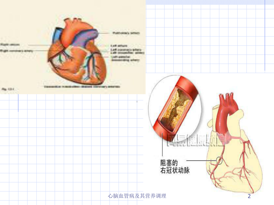 心脑血管病及其营养调理课件.ppt_第2页