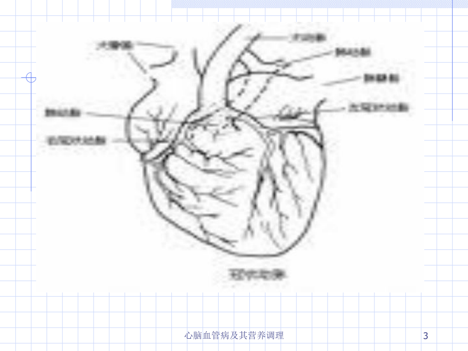 心脑血管病及其营养调理课件.ppt_第3页