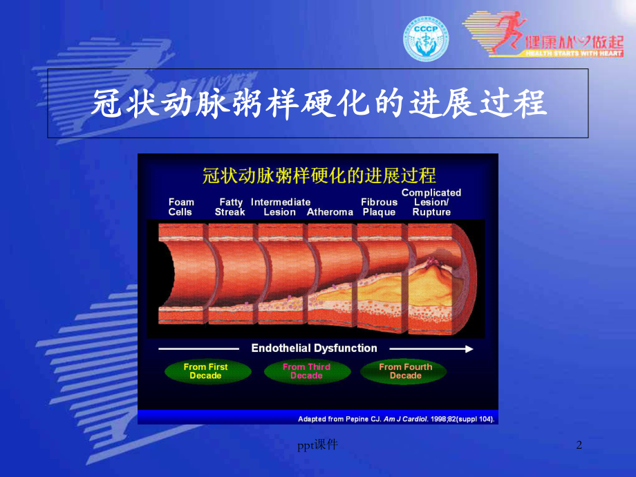 心血管疾病介入性治疗-课件.ppt_第2页