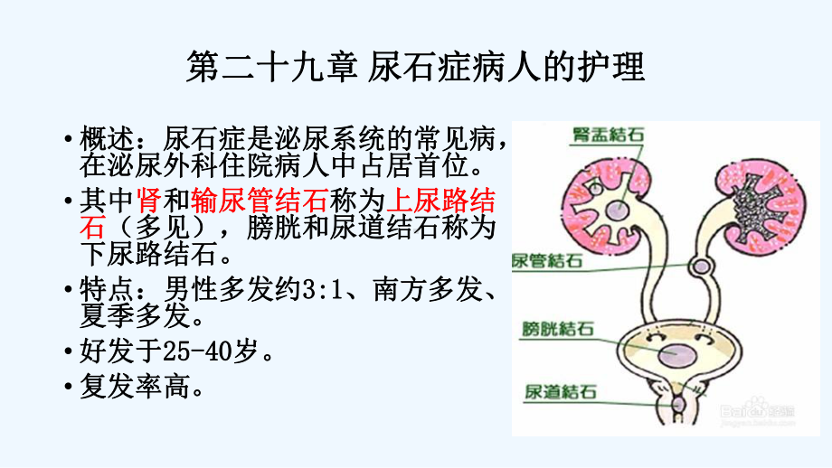 尿石症病人的护理课件.pptx_第1页