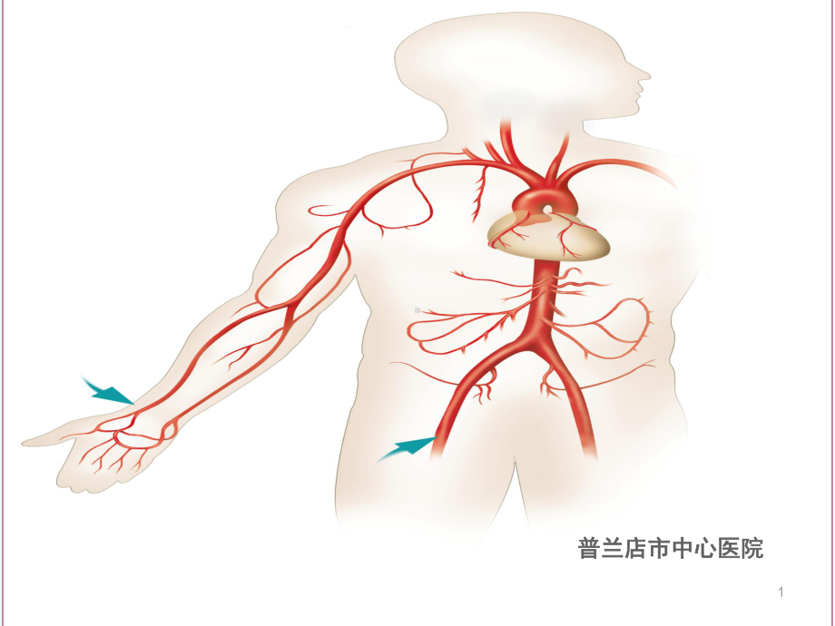 时家义急性冠脉综合征介入治疗策略课件.ppt_第1页