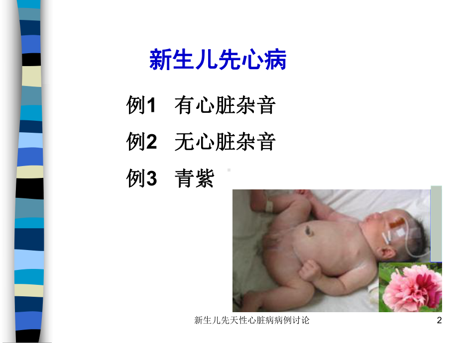 新生儿先天性心脏病病例讨论培训课件.ppt_第2页