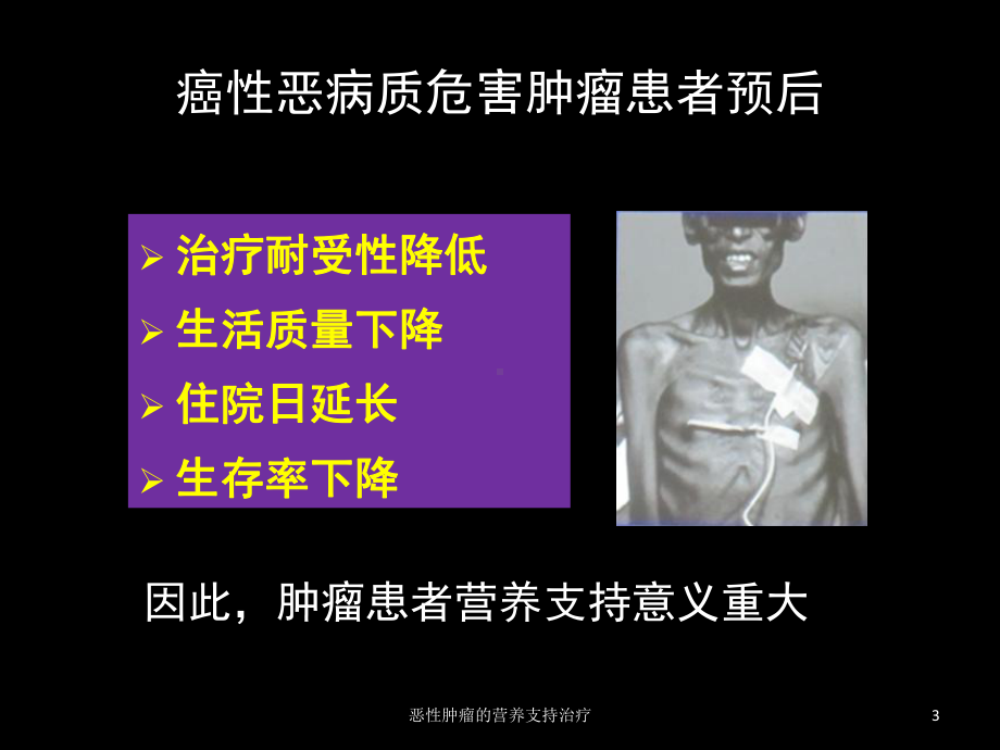 恶性肿瘤的营养支持治疗培训课件.ppt_第3页