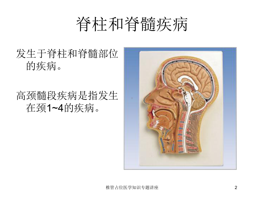 椎管占位医学知识专题讲座培训课件.ppt_第2页