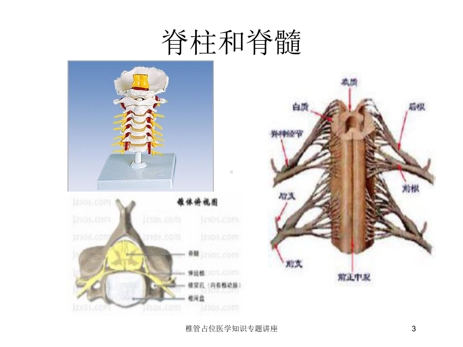 椎管占位医学知识专题讲座培训课件.ppt_第3页