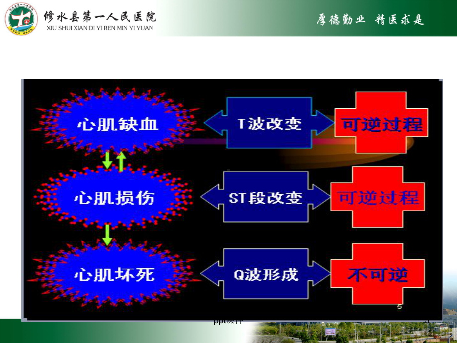 急性心肌梗死及常见心电图识别-课件.ppt_第3页