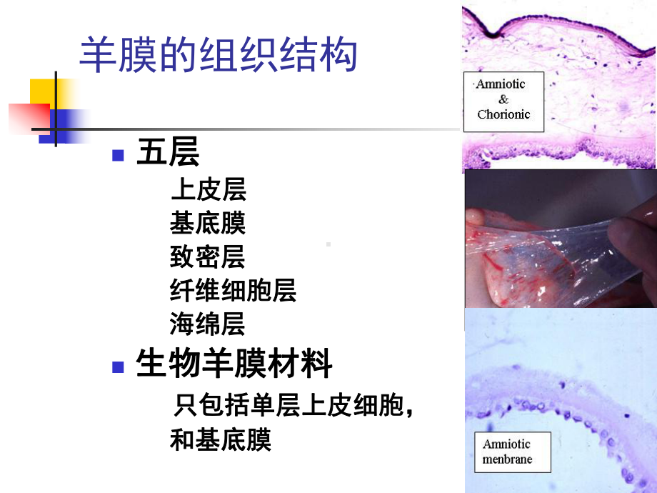 新型凹凸面生物羊膜介绍课件.ppt_第3页