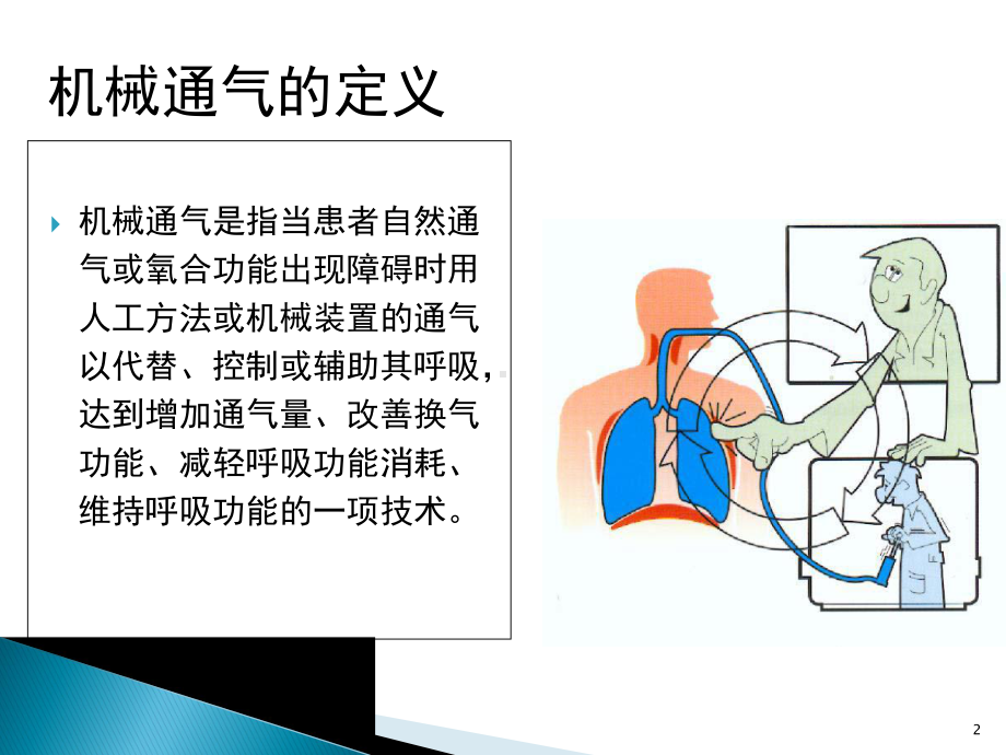 机械通气的护理要点优质课件.ppt_第2页